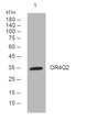 Western blot analysis of lysates from Hela cells, primary antibody was diluted at 1:1000, 4°C over night Western blot analysis of lysates from Hela cells, primary antibody was diluted at 1:1000, 4°C over night