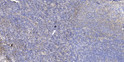 Immunohistochemical analysis of paraffin-embedded human tonsil. 1, Antibody was diluted at 1:200 (4°C overnight). 2, Tris-EDTA, pH9.0 was used for antigen retrieval. 3, Secondary antibody was diluted at 1:200 (room temperature, 30min).