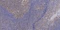 Immunohistochemical analysis of paraffin-embedded human tonsil. 1, Antibody was diluted at 1:200 (4°C overnight). 2, Tris-EDTA, pH9.0 was used for antigen retrieval. 3, Secondary antibody was diluted at 1:200 (room temperature, 30min).