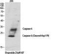 Western blot analysis of various cells using Cleaved-Caspase-6 p18 (D179) Polyclonal Antibody diluted at 1：1000