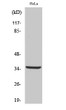 Western Blot analysis of various cells using Cleaved-Cathepsin L2 (L114) Polyclonal Antibody STJ90044