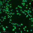 Immunofluorescence analysis of Siha cells. 1, Primary antibody was diluted at 1:100 (4℃ overnight). 2, Goat Anti Rabbit STJ90044