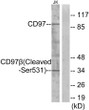 Western blot analysis of lysates from Jurkat cells, treated with etoposide 25uM 24h, using CD97 beta (Cleaved-Ser531) Antibody. The lane on the right is blocked with the synthesized peptide.