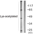Western blot analysis of lysates from COS7 cells treated with TSA 400 µM 24 h, using Lys-Acetylated Proteins Antibody. STJ90135