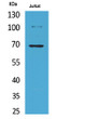 Western blot analysis of Jurkat cells using Acetyl-Ku-70 (K542) Polyclonal Antibody.. Secondary antibody was diluted at 1:20000
