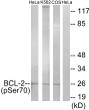 Western blot analysis of lysates from HeLa cells treated with LPS (40nM, 30mins), K562 cells treated with calyculin A (50ng/ml, 30mins) and COS-7 cells treated with H2O2 (1ng/ml, 15mins), using BCL-2 (Phospho-Ser70) Antibody. The lane on the right is blocked with the phospho peptide.