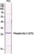 Western blot analysis of various cells using Phospho-Bcl-2 (S70) Polyclonal Antibody diluted at 1：1000