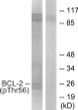 Western blot analysis of lysates from K562 cells treated with H2O2 100uM 30', using BCL-2 (Phospho-Thr56) Antibody. The lane on the right is blocked with the phospho peptide.