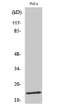 Western blot analysis of HeLa cells using Phospho-Caveolin-1 (Y14) Polyclonal Antibody diluted at 1：1000