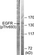 Western blot analysis of lysates from A431 cells, using EGFR (Phospho-Thr693) Antibody. The lane on the right is blocked with the phospho peptide.