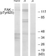 Western blot analysis of lysates from Jurkat and HepG2 cells, using FAK (Phospho-Tyr925) Antibody. The lane on the right is blocked with the phospho peptide.