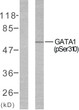 Western blot analysis of lysates from COS7 cells treated with EPO, using GATA1 (Phospho-Ser310) Antibody. The lane on the left is blocked with the phospho peptide.