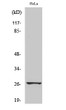 Western blot analysis of various cells using Phospho-HSP27 (S78) Polyclonal Antibody STJ90295