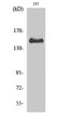Western blot analysis of various cells using Phospho-Met (Y1349) Polyclonal Antibody diluted at 1:1000 STJ90335