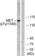 Western blot analysis of lysates from HepG2 cells, using Met (Phospho-Tyr1349) Antibody. The lane on the right was STJ90335