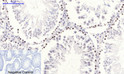 Immunohistochemical analysis of paraffin-embedded Rat-testis tissue. 1, NF Kappa B-p65 (phospho Ser536) Polyclonal Antibody was diluted at 1:200 (4°C, overnight). 2, Sodium citrate pH 6.0 was used for antibody retrieval (>98°C, 20min). 3, Secondary antibody was diluted at 1:200 (room tempeRature, 30min). Negative control was used by secondary antibody only.