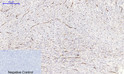 Immunohistochemical analysis of paraffin-embedded Human-uterus tissue. 1, NF Kappa B-p65 (phospho Ser536) Polyclonal Antibody was diluted at 1:200 (4°C, overnight). 2, Sodium citrate pH 6.0 was used for antibody retrieval (>98°C, 20min). 3, Secondary antibody was diluted at 1:200 (room tempeRature, 30min). Negative control was used by secondary antibody only.