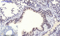Immunohistochemical analysis of paraffin-embedded Mouse-lung tissue. 1, NF Kappa B-p65 (phospho Ser536) Polyclonal Antibody was diluted at 1:200 (4°C, overnight). 2, Sodium citrate pH 6.0 was used for antibody retrieval (>98°C, 20min). 3, Secondary antibody was diluted at 1:200 (room tempeRature, 30min). Negative control was used by secondary antibody only.