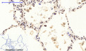Immunohistochemical analysis of paraffin-embedded Human-lung tissue. 1, NF Kappa B-p65 (phospho Ser536) Polyclonal Antibody was diluted at 1:200 (4°C, overnight). 2, Sodium citrate pH 6.0 was used for antibody retrieval (>98°C, 20min). 3, Secondary antibody was diluted at 1:200 (room tempeRature, 30min). Negative control was used by secondary antibody only.