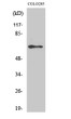Western blot analysis of COLO205 cells using Phospho-NF Kappa B-p65 (S536) Polyclonal Antibody diluted at 1：2000