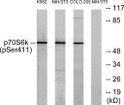 Western blot analysis of lysates from K562 cells, NIH/3T3 cells, and COLO205 cells, using p70 S6 Kinase STJ90373