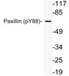 Western blot analysis of lysate from HeLa cells using phospho-Paxillin (Phospho-Tyr88) antibody. STJ90381