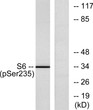 Western blot analysis of lysates from 293 cells treated with 10% serum for 15', using S6 Ribosomal Protein STJ90403