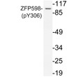 Western blot analysis of lysate from Jurkat cells, uisng phospho-ZFP598 (Phospho-Tyr306) antibody.