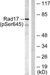 Western blot analysis of lysates from HeLa cells treated with UV 15', using RAD17 (Phospho-Ser645) Antibody. The lane STJ90451