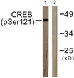 Western blot analysis of lysates from HeLa cells treated with Etoposide 25 μM 24 h, using CREB (Phospho-Ser121) STJ90463