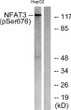 Western blot analysis of lysates from HepG2 cells treated with Ca2+ 40 μM 30', using NFAT3 (Phospho-Ser676) Antibody. STJ90473