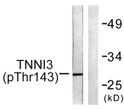 Western blot analysis of lysates from mouse heart, using TNNI3 (Phospho-Thr142) Antibody. The lane on the right was STJ90481