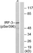 Western blot analysis of lysates from Jurkat cells treated with EGF 200 ng/ml for 30', using IRF-3 (Phospho-Ser396) STJ90486