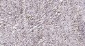Immunohistochemical analysis of paraffin-embedded human small intestinal stromal tumor. 1, Tris-EDTA, pH 9.0 was used STJ90490