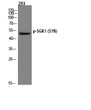 Western blot analysis of 293 cells using p-SGK1 (S78) antibody. Antibody was diluted at 1:2000. STJ90493