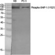 Western blot analysis of various cells using Phospho-SHIP-1 (Y1021) polyclonal antibody diluted at 1:500 STJ90494