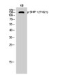 Western blot analysis of KB cells using Phospho-SHIP-1 (Y1021) Polyclonal Antibody diluted at 1:500 STJ90494