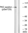 Western blot analysis of lysates from HeLa cells treated with PMA 125 ng/ml for 30', using PKC epsilon (Phospho-Ser729) STJ90500