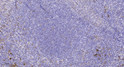 Immunohistochemical analysis of paraffin-embedded human tonsil. 1, Tris-EDTA, pH 9.0 was used for antigen retrieval. 2, STJ90507