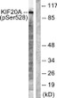 Western blot analysis of lysates from 293 cells, using KIF20A (Phospho-Ser528) Antibody. The lane on the right was STJ90533