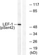 Western blot analysis of lysates from 293 cells treated with paclitaxel 1 µM 24 h, using LEF-1 (Phospho-Ser42) STJ90534