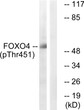 Western blot analysis of lysates from HUVEC cells treated with EGF 200ng/ml 5', using FOXO4 (Phospho-Thr451) Antibody. The lane on the right is blocked with the phospho peptide.