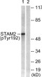Western blot analysis of lysates from NIH/3T3 cells treated with EGF 200 ng/ml for 30', using STAM2 (Phospho-Tyr192) STJ90559