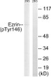 Western blot analysis of lysates from 293 cells treated with UV 15', using Ezrin (Phospho-Tyr146) Antibody. The lane on the right is blocked with the phospho peptide.