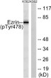 Western blot analysis of Ezrin (Phospho-Tyr478) Antibody. The lane on the right was blocked with the Ezrin STJ90570