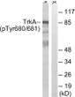 Western blot analysis of lysates from Jurkat cells treated with starved 24h, using Trk A (Phospho-Tyr680+Tyr681) Antibody. The lane on the right is blocked with the phospho peptide.