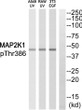 Western blot analysis of MAP2K1 (Phospho-Thr386) Antibody. The lane on the right is blocked with the MAP2K1 (Phospho-Thr386) peptide.