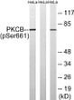 Western blot analysis of lysates from HeLa cells treated with heat shock, using PKCβ (Phospho-Ser661) Antibody. The STJ90592