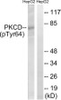 Western blot analysis of lysates from HepG2 cells treated with PMA 125ng/ml 30', using PKCD (Phospho-Tyr64) Antibody. The lane on the right is blocked with the phospho peptide.