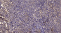 Immunohistochemical analysis of paraffin-embedded human uterus. 1, Antibody was diluted at 1:200 (4° overnight). 2, STJ90593